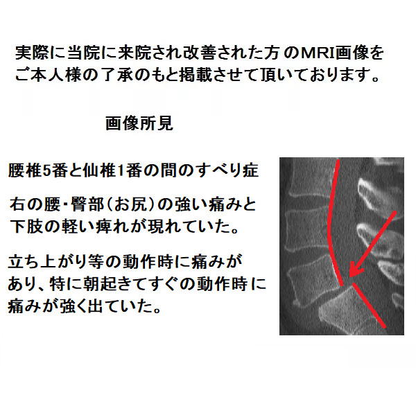 すべり11a.png