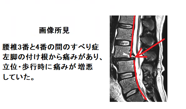 すべり12a.png