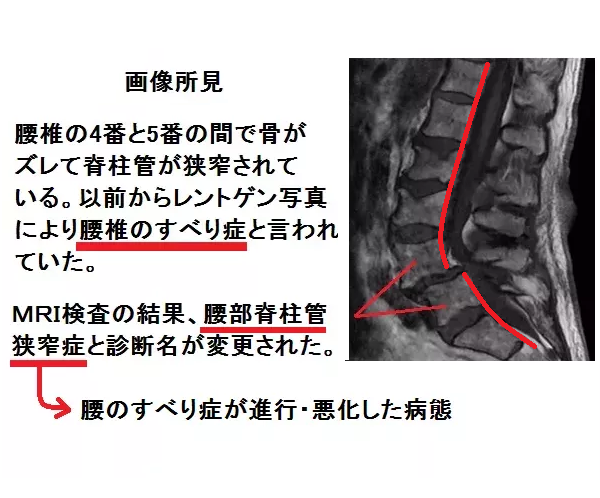 すべり13a.png