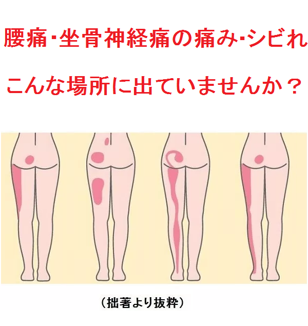 左ヘッドラインざこつ左.png
