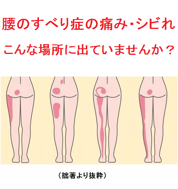 左ヘッドラインすべり.png