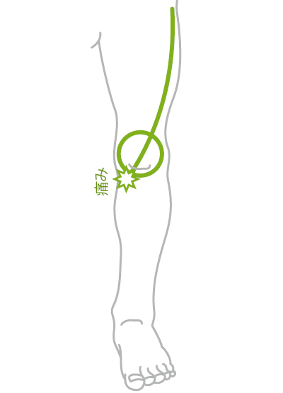 ひざひざ２無題.png