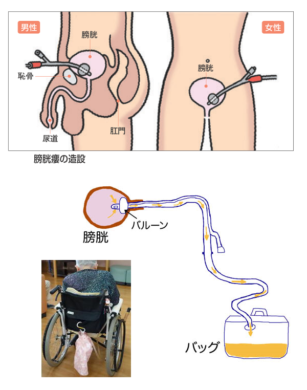 ブログ用.png