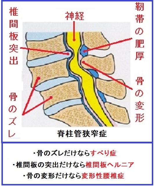 断面２.jpg