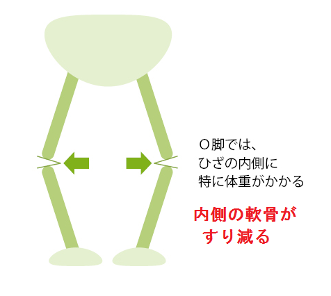 膝３無題.png