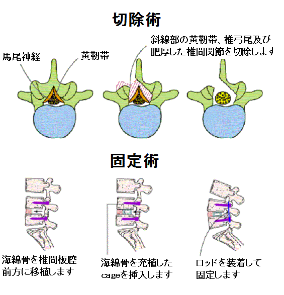 術式.png