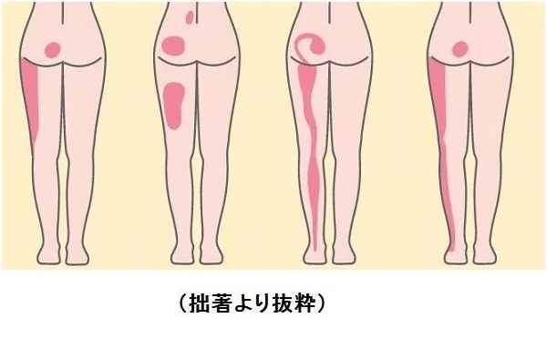 gg無題.png